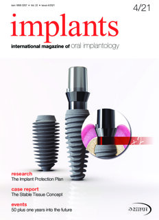 implants-international-no-4-2021