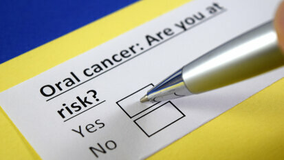 I tassi di cancro orale salgono alle stelle nel Regno Unito