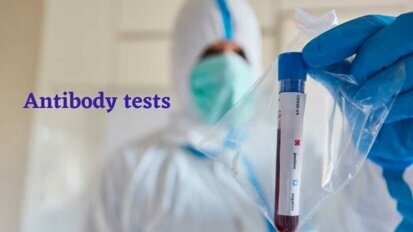 Les tests d'anticorps COVID-19 ne sont pas recommandés pour mesurer l'immunité après la vaccination