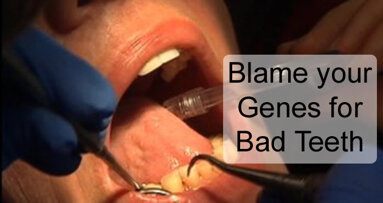 Blame your Genes for Bad Teeth