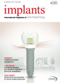 implants international No. 4, 2020