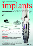 implants Italy No. 2, 2023