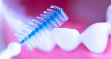 Szczoteczki międzyzębowe i gumowe wykałaczki to najskuteczniejsze urządzenia do higieny