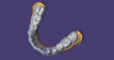 Exocad DentalCAD 3.2 Elefsina update includes more than 60 new features