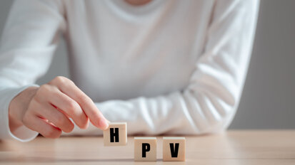 Estudo finlandês encontra saúde bucal pior em pacientes com câncer de orofaringe com HPV do que pacientes com câncer de língua