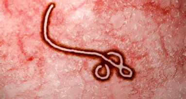 Preporuke za stomatologe u vezi sa širenjem ebola virusa