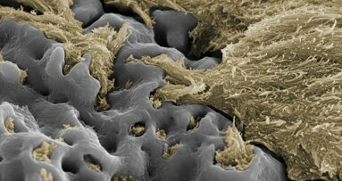Review confirms clinical success of Nobel Biocare’s TiUnite surface