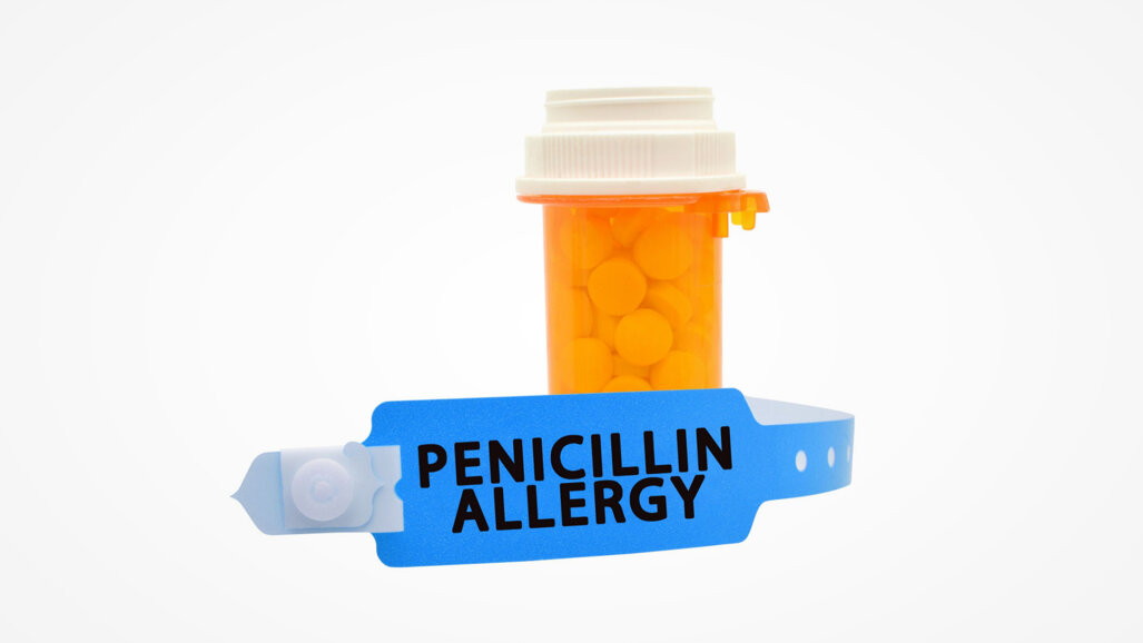 Os médicos devem confirmar as alegações de alergia à penicilina para evitar o uso excessivo de antibióticos na Odontologia