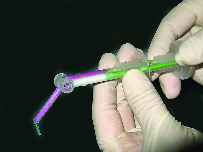 Fig. 6-7. 3M Imprint 4 Light is placed from the 3M Garant Dispenser into a 3M Intraoral Syringe, and the tip can be directed for precise application