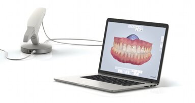 La solution d'empreinte numérique TRIOS Color de 3Shape inclut désormais une fonctionnalité de mesure des teintes dentaires