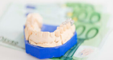 Svezia: il parere dei dentisti sul servizio che mette a confronto i costi di cura nel settore odontoiatrico