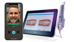 Interview: Benefits of Invisalign Smile Architect