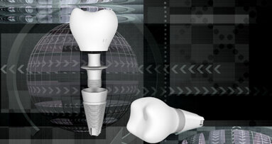 Dental genial: Digitale Praxis und Labor im Fokus der IDS 2013