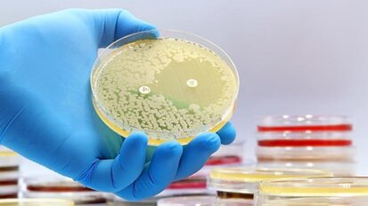 Proces uodparniania się drobnoustrojów na antybiotyki przyspiesza