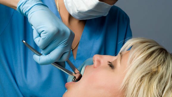 Академията за екстракции“ помага на зъболекарите да предоставят безопасни и ефективни процедури