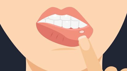Gefährdung der Krebsbehandlung durch Entzündungen der Mundschleimhaut