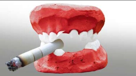 吸烟者较非吸烟者更不愿意看牙医