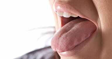 Sensibilidade ao gosto amargo pode prever o resultado cirúrgico em pacientes com sinusite