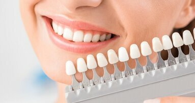 Researchers develop less destructive method to whiten teeth