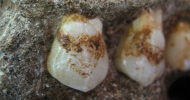 Pflanzenreste in zwei Millionen Jahre altem Zahnbelag entdeckt
