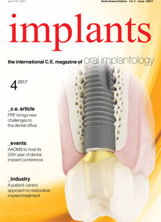 implants C.E. No. 4, 2017