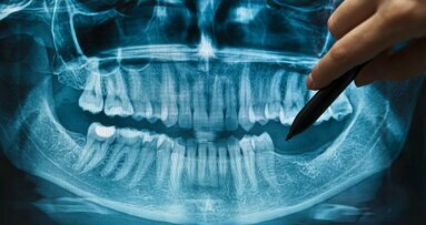 Herziene richtlijn Tandheelkundige radiologie open voor commentaar