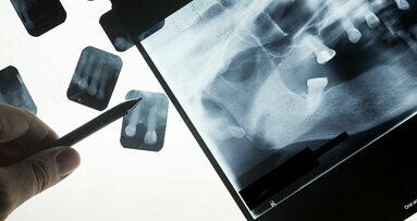 Nascholingsplicht voor tandarts die röntgenopnamen maakt
