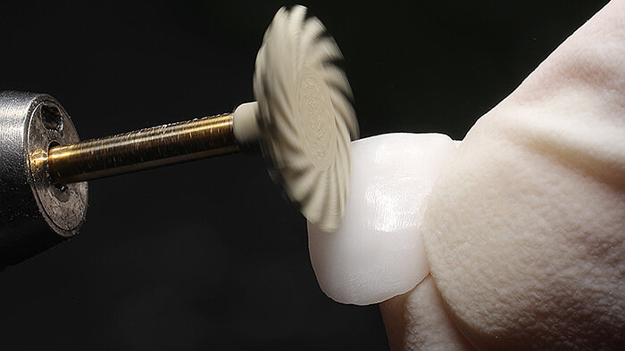 Fig. 11: A simple high-gloss polish was enough to finish the restorations.