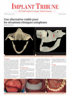 Implant Tribune France No. 3, 2022