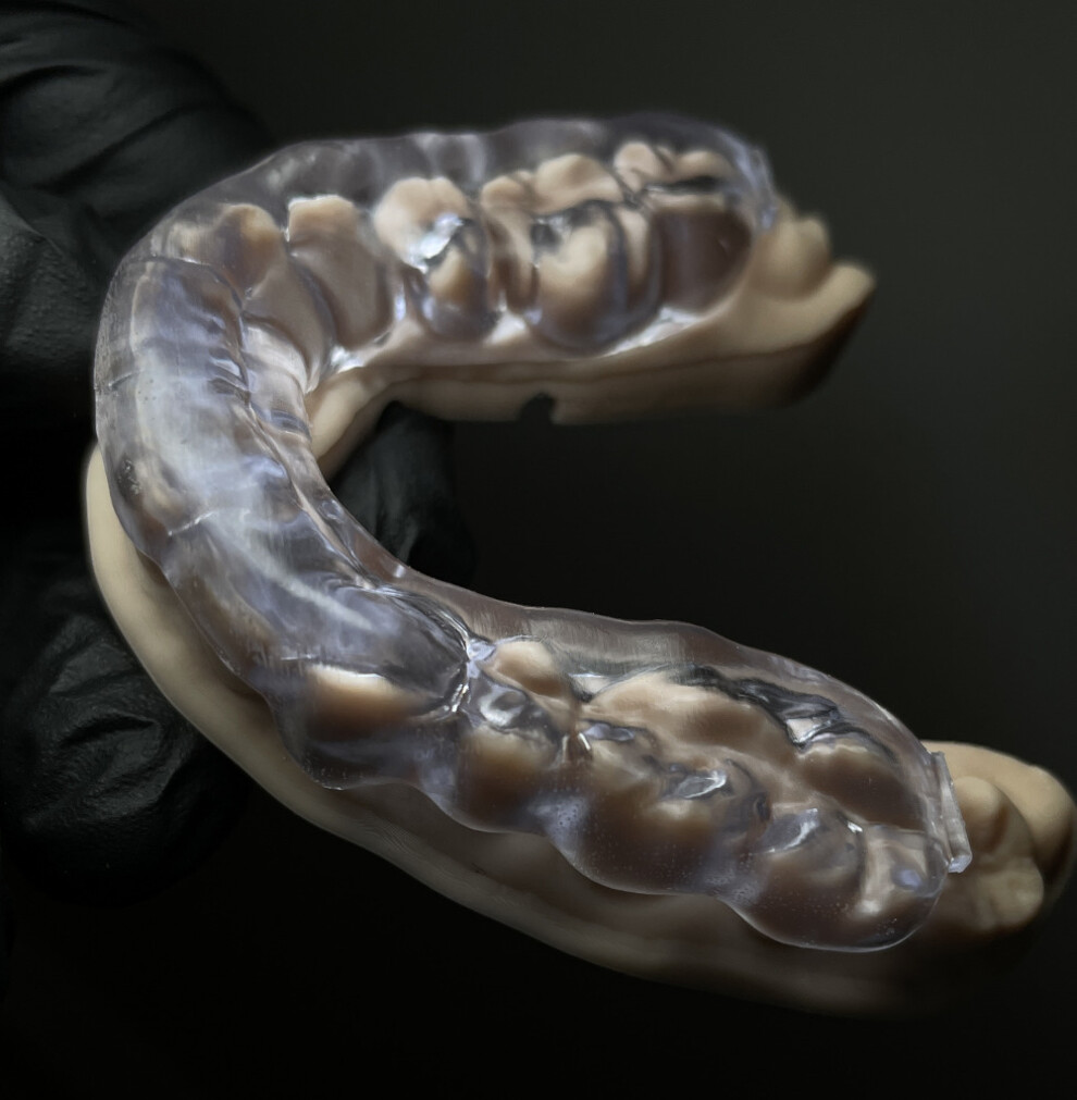 Fig. 9c: Occlusal view of the splint.