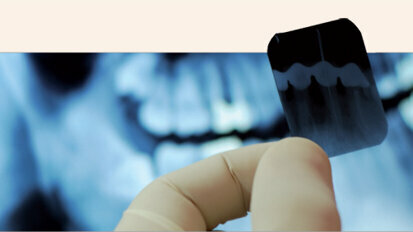 Vědci varují: zubní rentgeny zvyšují riziko vzniku rakoviny