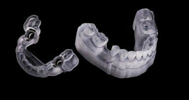 Digitalização do padrão ouro de implantodontia