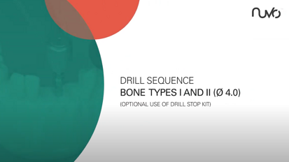 ConicalFIT Drill Sequence Bone Types I&II