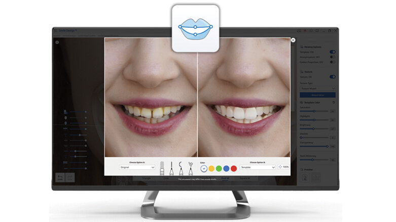 Medit Smile Design can show patients their future smile