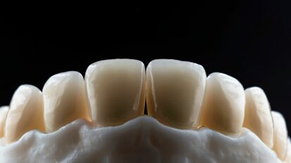3D-printen biedt voordelen voor de tandartsenpraktijk