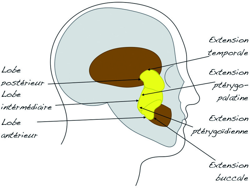 Fig. 6 : Lobes et extensions du corps adipeux de la joue.