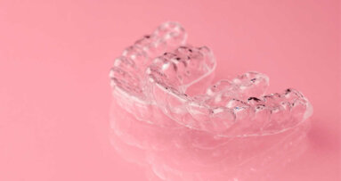 Dentalna smola, ki se uporablja pri 3D tiskanju, lahko ogrozi reproduktivno zdravje