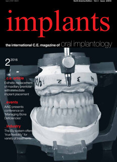 implants C.E. No. 2, 2016