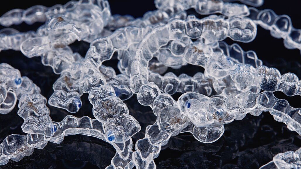 How far has 3D printing brought clear aligners?