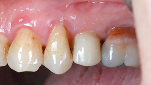 “The Patent Dental Implant System is the best choice for every patient and dentist”