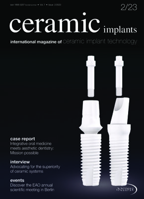 ceramic implants international No. 2, 2023