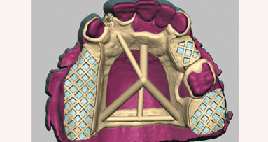 SensAble Technologies names Core 3D as worldwide authorized milling center
