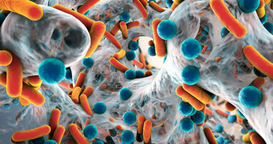 Resistenze batteriche, sondaggio europeo rivolto a odontoiatri, AIO in prima linea