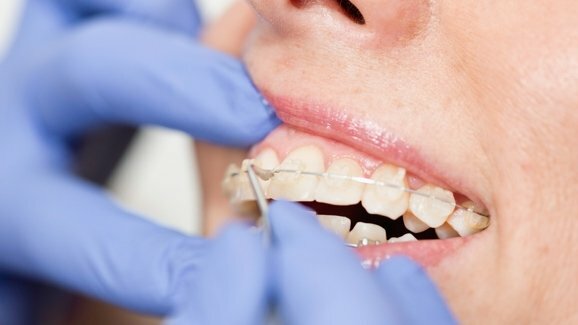 Simpósio AIO-SIDO apresenta as atualizações mais recentes em ortodontia
