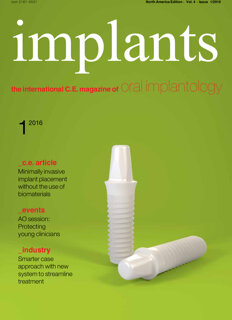 implants C.E. No. 1, 2016