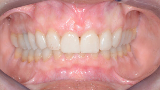 Un nuovo sorriso grazie alla Medicina Estetica Odontoiatrica