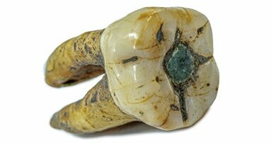 Las asombrosas decoraciones dentales de la antigüedad