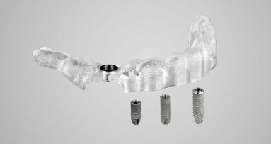 Dentsply Sirona Implants lancia Acuris, l’innovazione più recente nel campo dell’implantologia