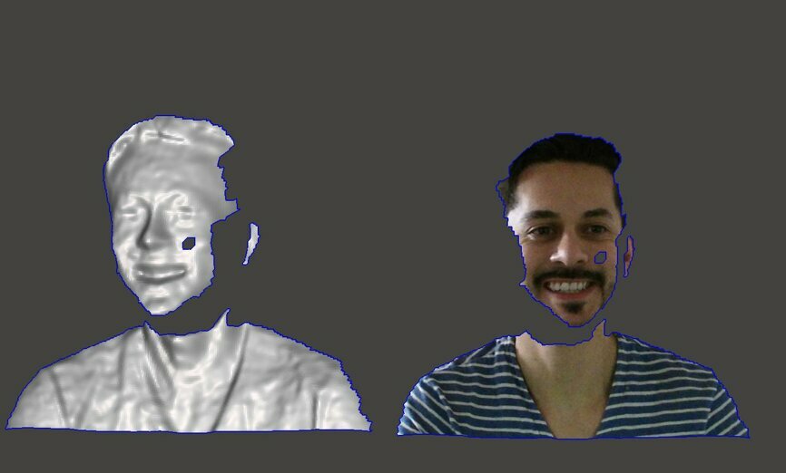 Fig. 5: 3D facial scan showing the same mesh with and without colour. The quality of the mesh without colour can be appreciated and is not a good representation
of the patient anatomy for registration purposes.