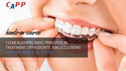 Clear Aligners: Basic Principles in Treatment Orthodontic Malocclusions